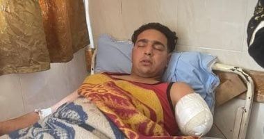 ننشر أول صورة لعامل السيرك بعد بتر ذراعه داخل مستشفى جامعة طنطا