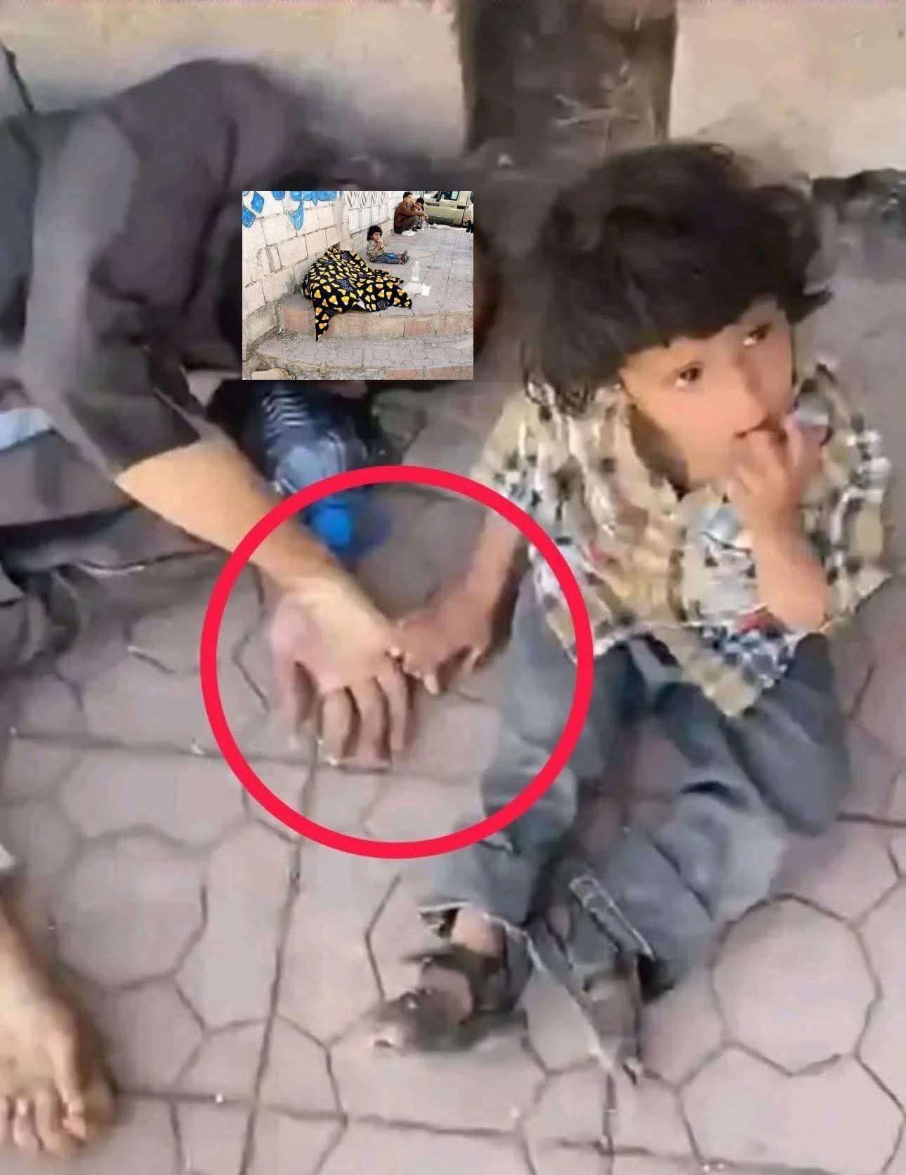 اول تعليق حكومي على وفاة مواطن وهو يحتضن طفله بإب