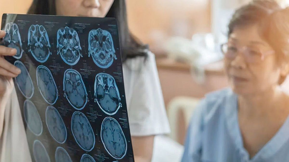 الامارات | أعراض الإصابة بالزهايمر المبكر في منتصف العمر.. هل النسيان ناقوس خطر؟
