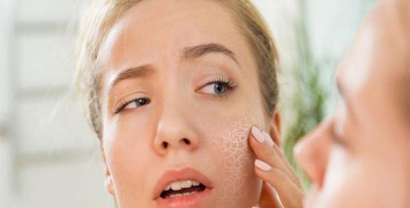 أسباب جفاف الجلد وعلاقته بالتغيرات المناخية.. كيف تحافظين على نضارة بشرتك؟