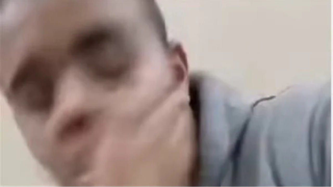 لن تصدق السبب...فتاة تصفع طبيب أسنان داخل عيادته