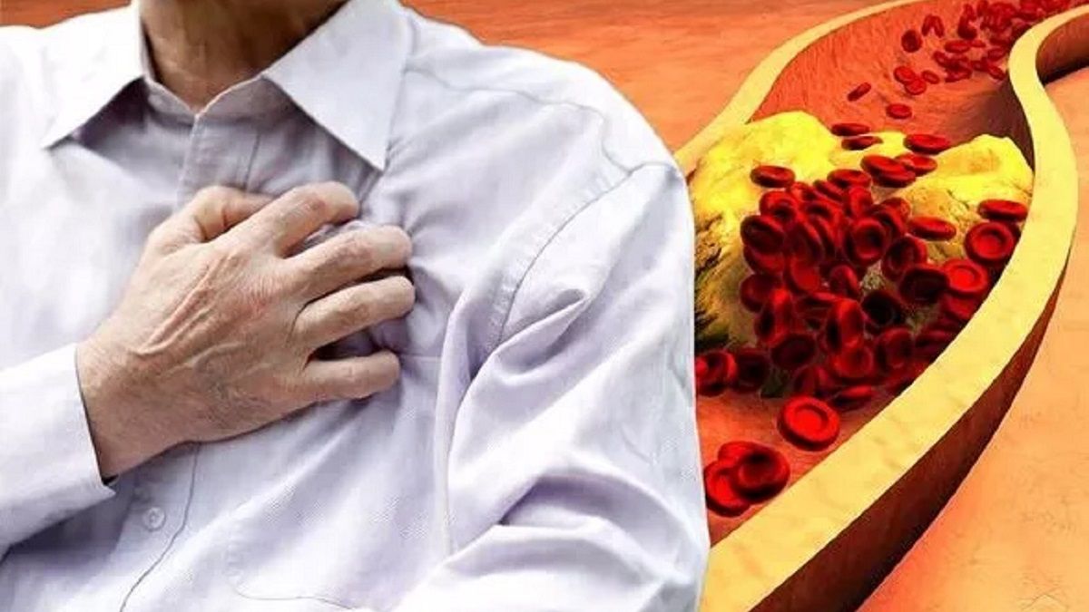 الامارات | تحذير إلى أصحاب الكوليسترول المرتفع.. انتبهوا إلى هذه الأطعمة لأجل صحتكم