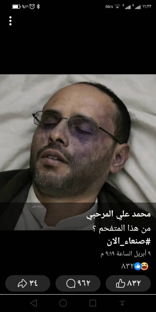 عاجل : نشر اول صورة لمهدي المشاط بعد إصابته بقصف أمريكي