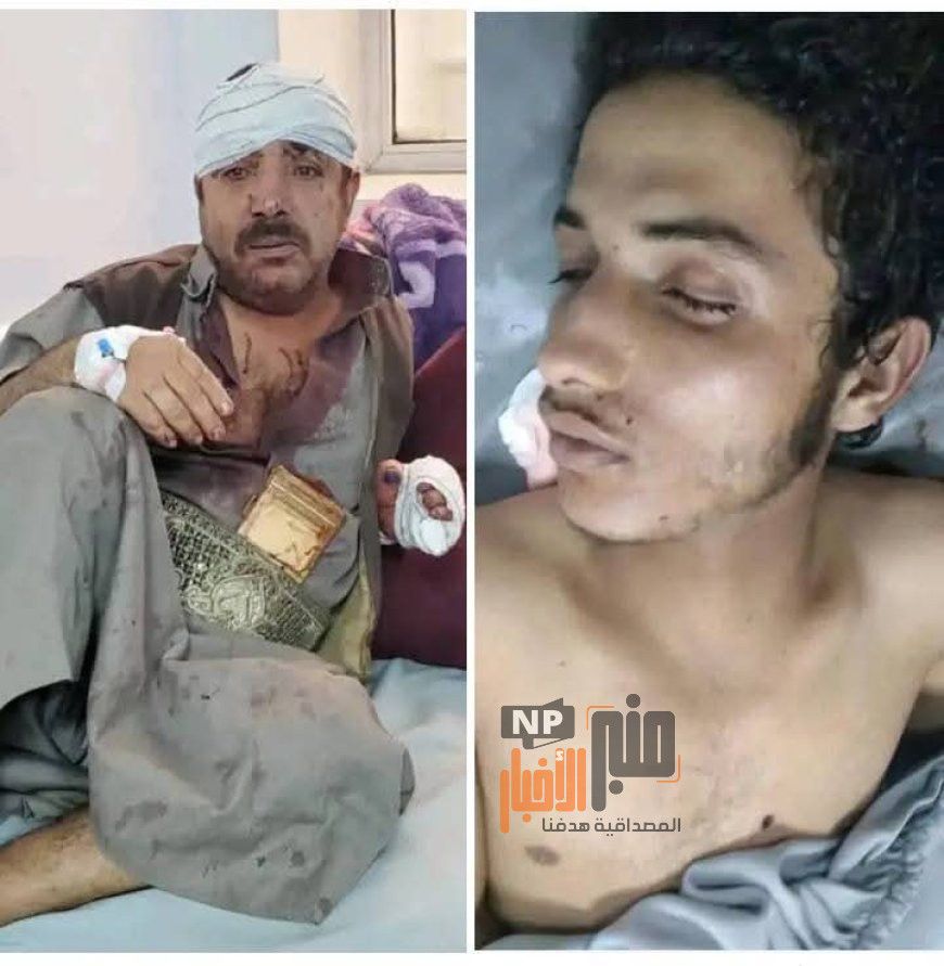 لا يصدق..هذا ماحدث بشارع الستين في صنعاء