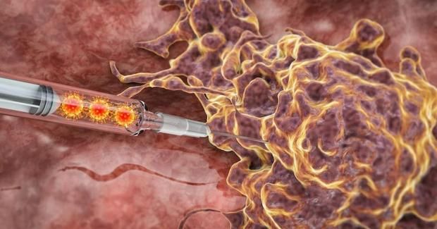 عاجل.. بعد وفاة إبراهيم شيكا.. أطعمة تقلل من خطر الإصابة بسرطان القولون والمستقيم