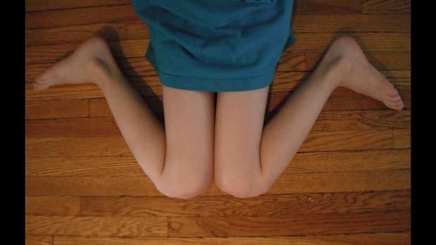 مخاطر الجلوس الخاطئ للأطفال.. طبيب عظام يقدم روشتة للوقاية منها