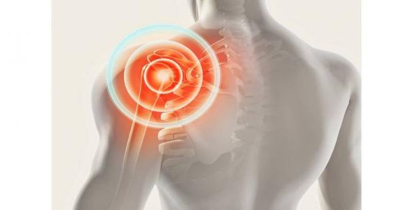 طبيب يوضح هل الخلع المتكرر للكتف له علاقة بنقص الفيتامينات؟