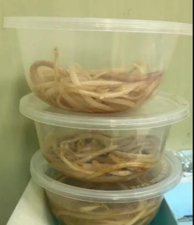 بعد نجاة طفل إندونيسي من الموت بسببها.. أعراض الإصابة بدودة الإسكارس