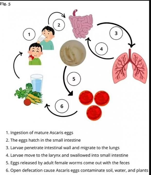 بعد نجاة طفل إندونيسي من الموت بسببها.. أعراض الإصابة بدودة الإسكارس
