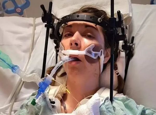 الامارات | جراحة نادرة لشابة أمريكية تعيد تثبيت جمجمتها فوق عمودها الفقري