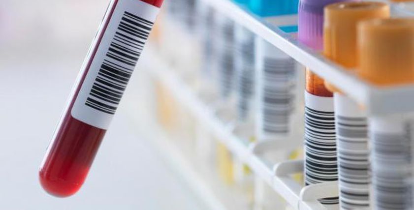 أمل جديد لمرضى السرطان.. تقنية جديدة للكشف المبكر بفحص «الحمض النووي»