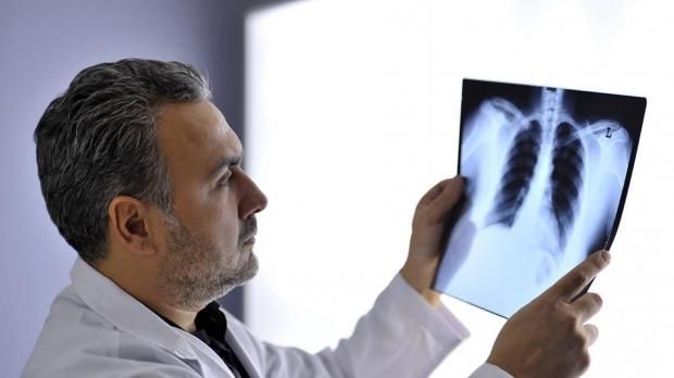 سبب وفاة البابا فرنسيس.. طبيب يكشف تفاصيل مرض بابا الفاتيكان