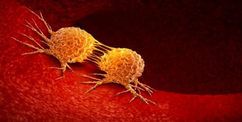 لا تتجاهل الإشارات الصامتة.. 18 علامة قد تنقذ حياتك من السرطان