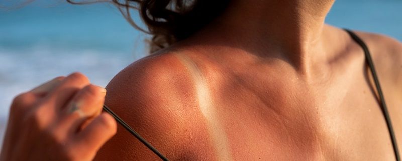 دليلك لطرق التسمير في الصيف.. من السولاريوم إلى مستحضرات البرونزاج