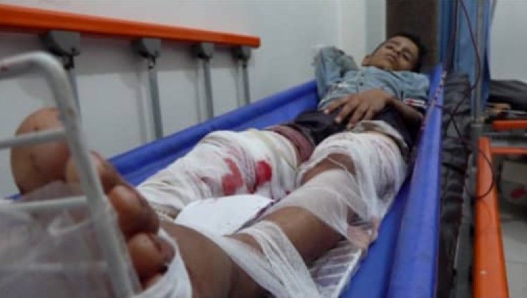 تعز.. إصابة طفلين برصاص قناص حوثي في منطقة الدمينة