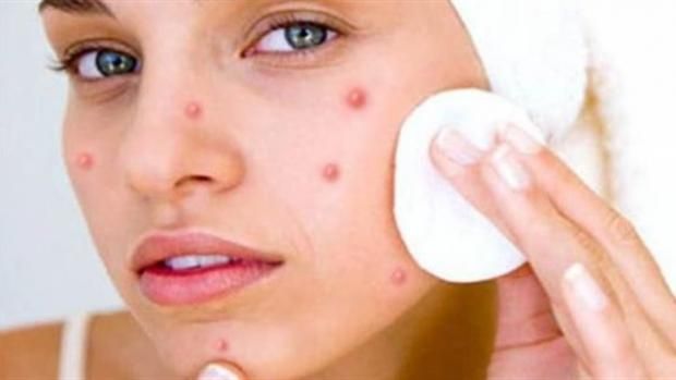 هل تعانين من حبوب بعد المكياج؟.. اكتشفي الأسباب وراء هذه الظاهرة