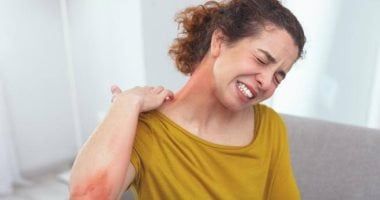 التوتر الشديد والأكزيما.. خطوات لوقف تأثير القلق على جلدك