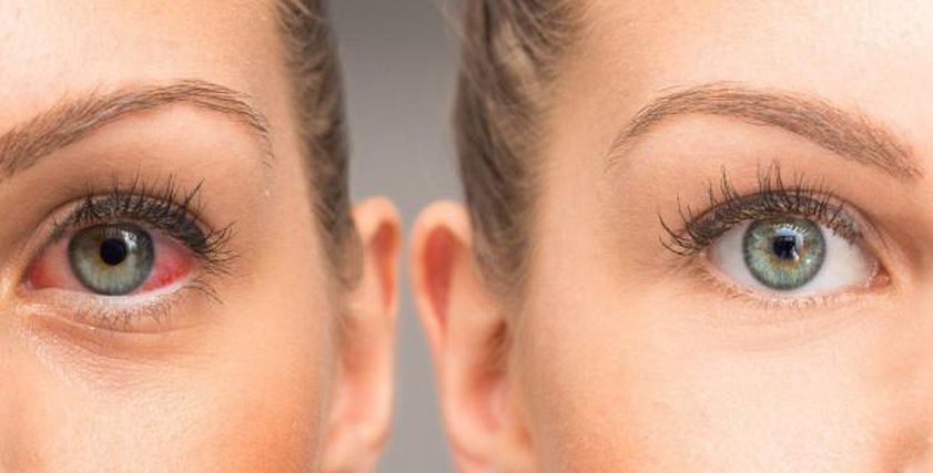 حقنة من الذهب تُعيد قوة البصر؟ دراسة حديثة تكشف العلاج الأكثر إثارة في عالم العيون