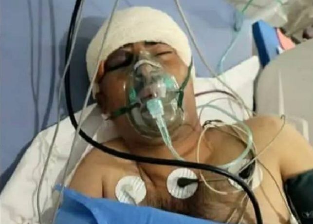 إب..مسلحون يعتدون بوحشية على بائع لرفضه دفع جبايات مالية