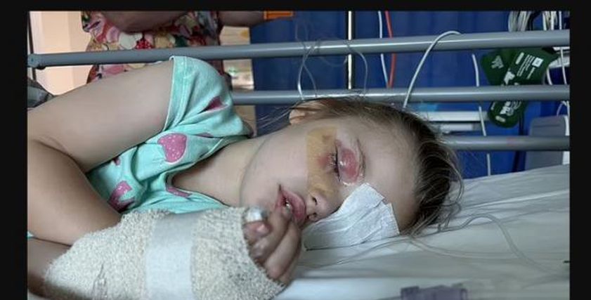 أضرار الإصابة بمواد التنظيف.. مسحوق غسيل شهير يصيب طفلة بالعمى