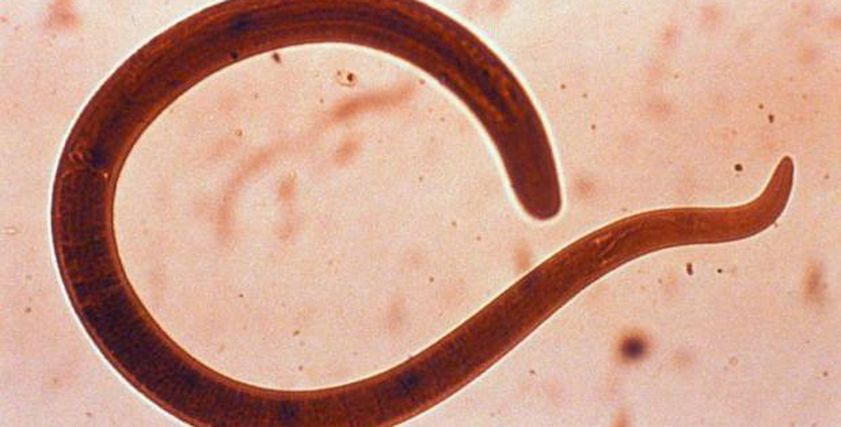 كارثة صحية قادمة.. انتشار دودة غامضة تتسبب في فشل الكبد