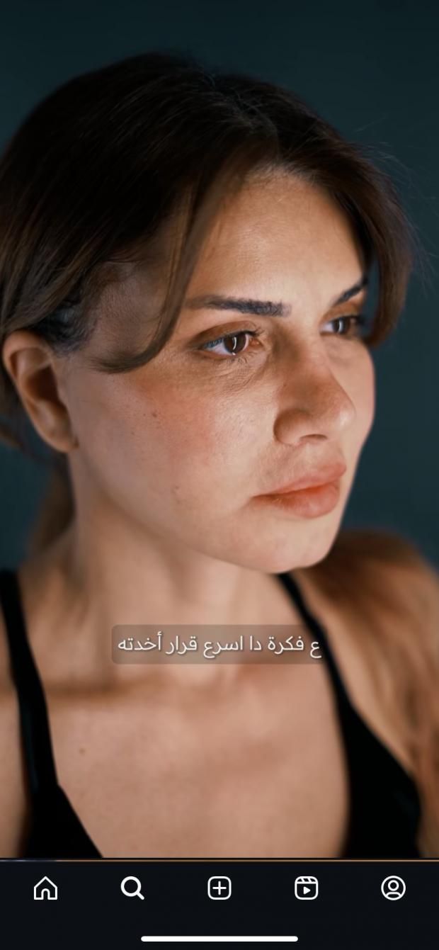 تستخدمها نجلاء بدر للظهور بملامح أصغر.. ماذا تعرف عن شرائط الوجه اللاصقة؟
