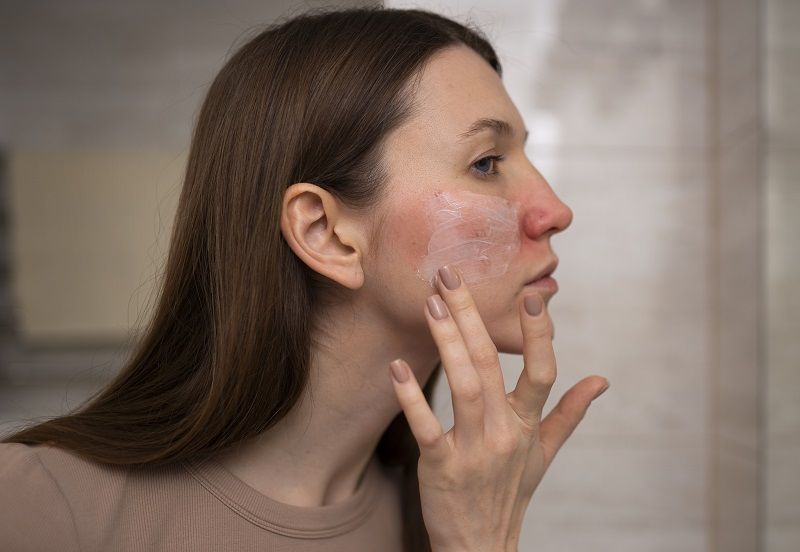 جفاف البشرة المفاجئ.. تعرفي إلى الأسباب وطرق الوقاية