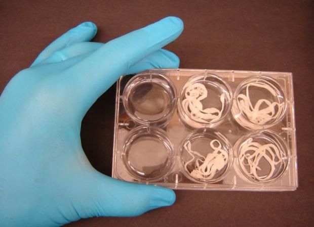 هل تناول الثوم على الريق يقتل ديدان البطن؟