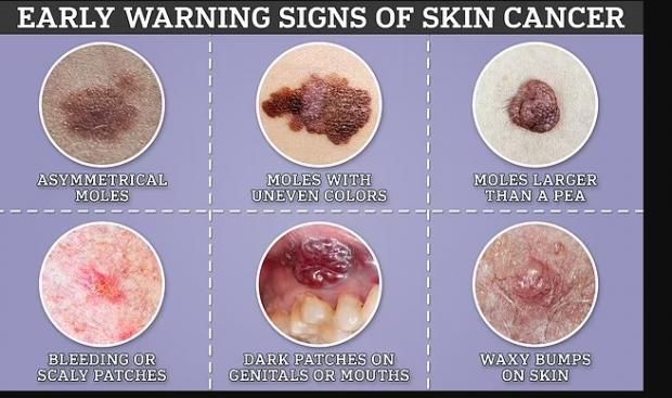 «حقنة خارقة» تكافح 15 نوعا من السرطان خلال 5 دقائق.. «عهد جديد في مكافحة المرض»