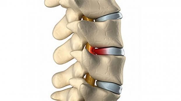 ما مرض خالد الصاوي؟.. رفض الخضوع لجراحة جديدة