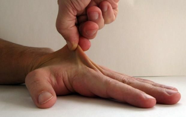 عادة يومية قد تنذر بأزمة صحية خطيرة.. 5 حركات للمفاصل وعلامات بالجلد تكشفها