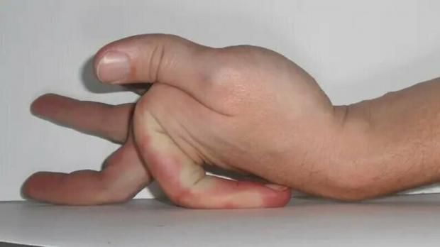 عادة يومية قد تنذر بأزمة صحية خطيرة.. 5 حركات للمفاصل وعلامات بالجلد تكشفها