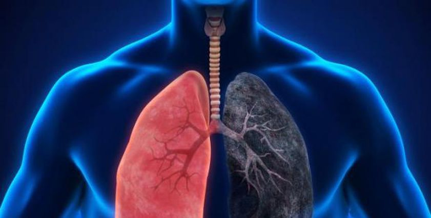 حقنة واحدة شهريا تحسِّن حياة مرضى الانسداد الرئوي
