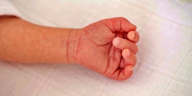 شبكة زرقاء على الجلد منذ الولادة قد تخفي أمراضًا خطيرة.. تعرف عليها