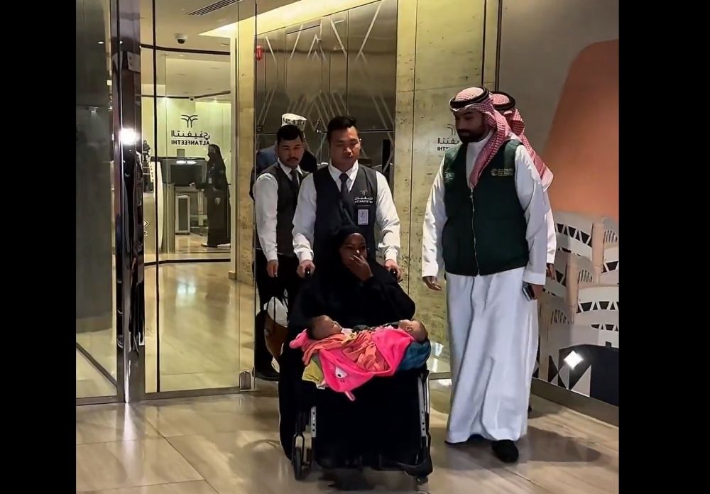 إشادة دولية.. نجاحات كبرى للبرنامج السعودي لفصل التوائم الملتصقة