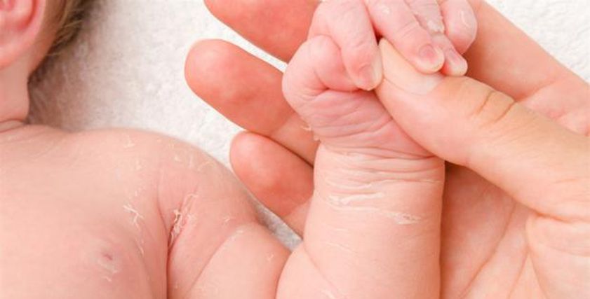 كيفية حماية جلد حديثي الولادة في الطقس الحار.. احمي طفلك بـ5 طرق