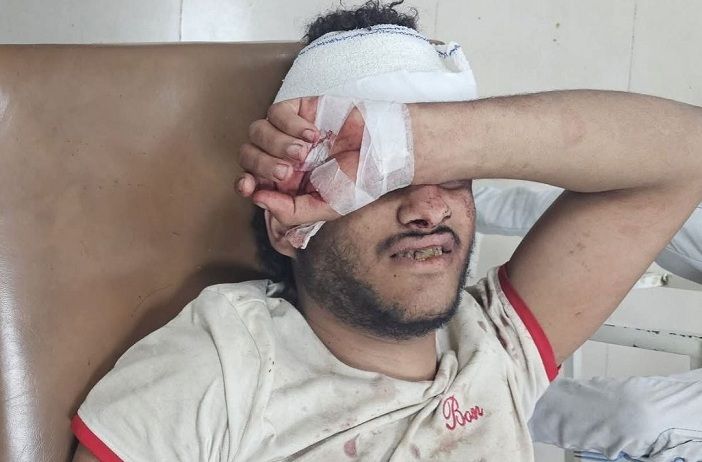 إصابة شاب بجروح بالغة برصاص قناص حوثي شرق تعز