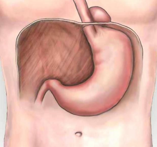 أعراضه خطيرة وأسبابه متعددة.. ماذا تعرف عن فتق الحجاب الحاجز؟