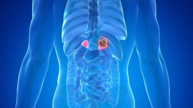 أسباب تغير شكل الوجه.. تعرف على «متلازمة كوشينج» وآثارها الجانبية