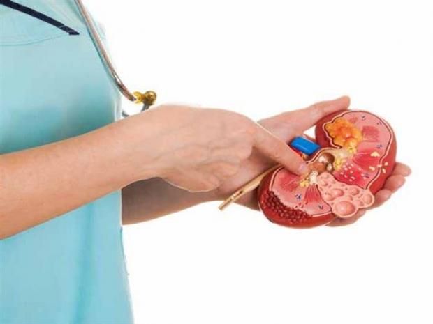 هل تعاني من ألم مفاجئ؟.. اعرف أسباب تكون حصى المرارة وأعراضها