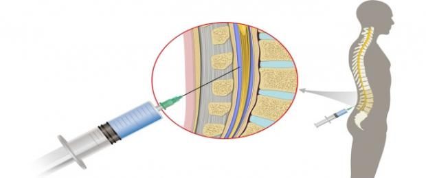 تعرف على مرض ابنة الفنان صبحي خليل.. «احتاجت 74 جلسة كيماوي»