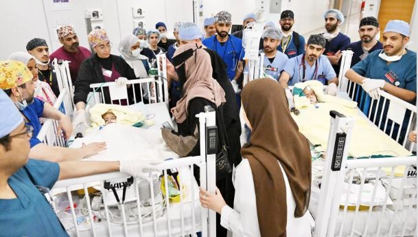 نجاح عملية فصل التوأم الملتصق الإريتري أسماء وسمية بعد عملية جراحية دقيقة