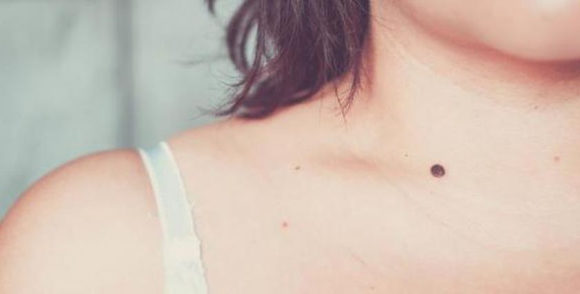 إصابة لاعبة كمال أجسام بسرطان قاتل.. احذر ظهور شامة غريبة