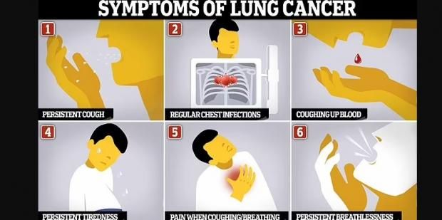 إصابة في الجيم تكشف عن سرطان خطير.. ألم لا يلاحظه أحد
