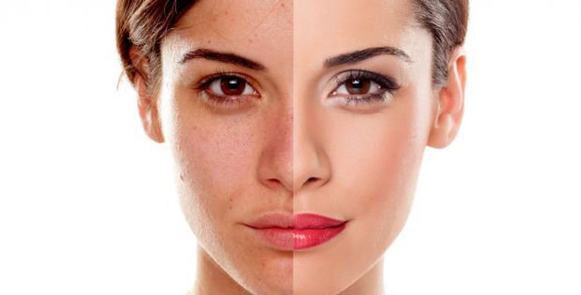 4 أطعمة ومشروبات تعزز نضارة البشرة وتحسن مظهرها