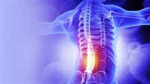 علاج مبتكر لآلام الظهر يحقق نتائج "مذهلة" ويؤجل الجراحة