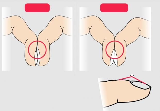 علامة في أطراف أصابعك قد تكون إنذارا للإصابة بسرطان الرئة