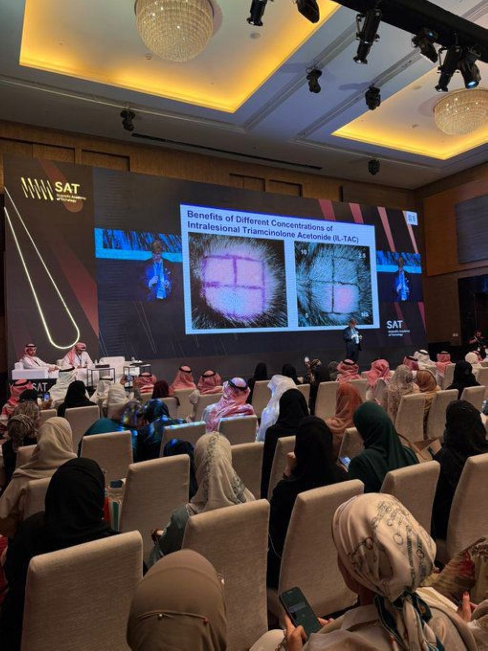 بمشاركة عالمية.. 750 طبيبًا يناقشون علاج تساقط الشعر في الرياض