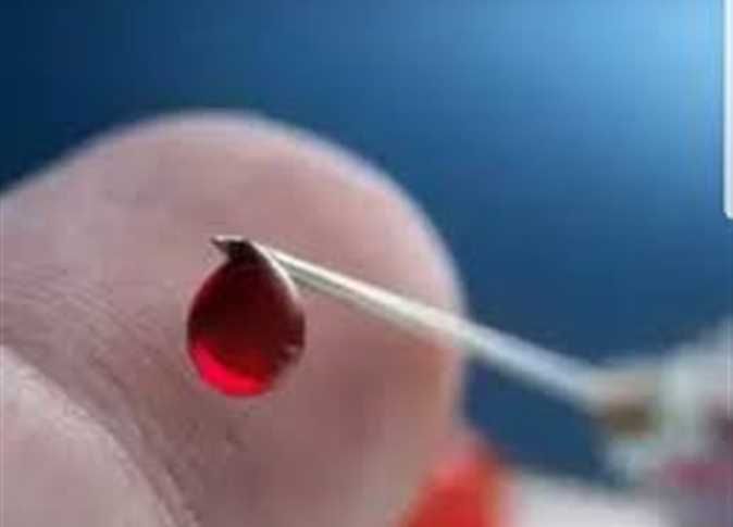 «صورة الأظافر» تكشف إصابتك بفقر الدم.. تطبيق جديد يراقب الهيموجلوبين دون قطرة دم واحدة