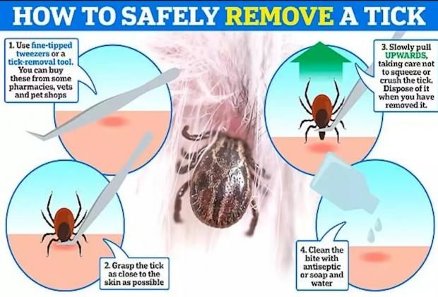 تحذير من فيروس ينقله البعوض في بريطانيا.. 11 علامة للإصابة به
